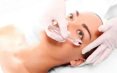 Rejuvenecimiento de Ojeras: La Magia del Ácido Hialurónico para una Mirada Fresca