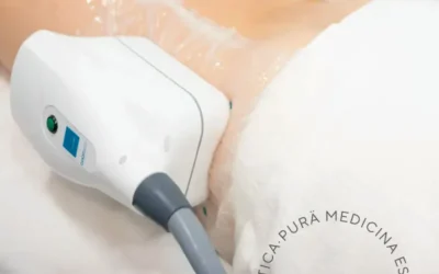 CoolSculpting: La Revolución en la Reducción de Grasa en Málaga y Nerja